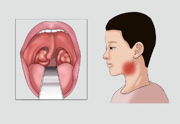 怎么正确喝酒更健康